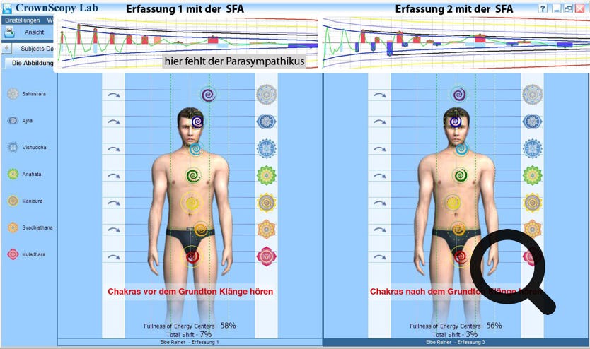 Ergebnis Vergleich der Stimmfrequenzanalyse mit der Kirlianfotographie